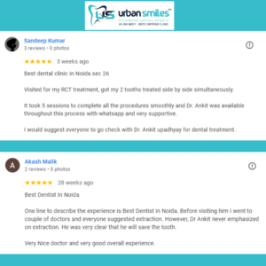 What Makes Urban Smiles the Best Dental Clinic in Noida